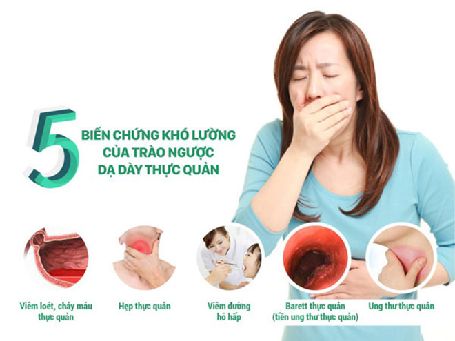 5 biến chứng khó lường của trào ngược dạ dày 